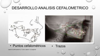 DESARROLLO ANALISIS CEFALOMETRICO
• Puntos cefalométricos
capitulo 6 proffit,capitulo 6 y 7 canut, capitulo 1,2,3 gregroret
• Trazos
 