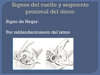 Signo de Hegar:
Por reblandecimiento del istmo
 