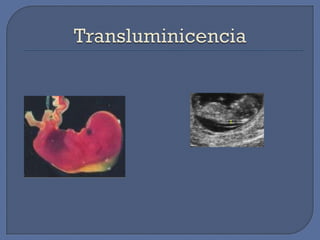 Diagnostico embarazo