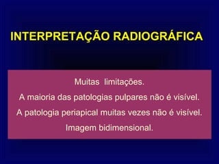 INTERPRETAÇÃO RADIOGRÁFICA


               Muitas limitações.
 A maioria das patologias pulpares não é visível.
A patologia periapical muitas vezes não é visível.
             Imagem bidimensional.
 