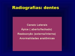 Radiografias: dentes



        Canais Laterais
    Ápice ( aberto/fechado)
  Reabsorção (externa/interna)
   Anormalidades anatômicas
 