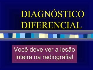DIAGNÓSTICO
  DIFERENCIAL

Você deve ver a lesão
inteira na radiografia!
 