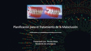 Planificación para el Tratamiento de la Maloclusión
Presentado por: Yessika Meza
Residente de ortodoncia
 