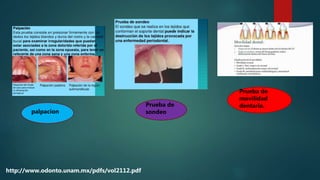 Prueba de
movilidad
dentaria.Prueba de
sondeopalpacion
http://www.odonto.unam.mx/pdfs/vol2112.pdf
 