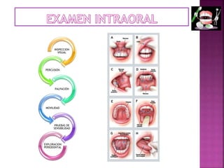 INSPECCION
VISUAL
PERCUSION
PALPACIÓN
MOVILIDAD
PRUEBAS DE
SENSIBILIDAD
EXPLORACION
PERIODONTAL
 