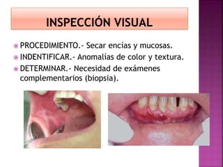  PROCEDIMIENTO.- Secar encías y mucosas.
 INDENTIFICAR.- Anomalías de color y textura.
 DETERMINAR.- Necesidad de exámenes
complementarios (biopsia).
 