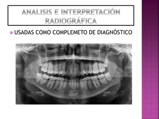  USADAS COMO COMPLEMETO DE DIAGNÓSTICO
 