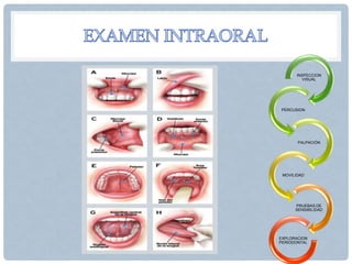 INSPECCION
VISUAL
PERCUSION
PALPACIÓN
MOVILIDAD
PRUEBAS DE
SENSIBILIDAD
EXPLORACION
PERIODONTAL
 