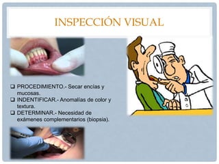 INSPECCIÓN VISUAL
 PROCEDIMIENTO.- Secar encías y
mucosas.
 INDENTIFICAR.- Anomalías de color y
textura.
 DETERMINAR.- Necesidad de
exámenes complementarios (biopsia).
 