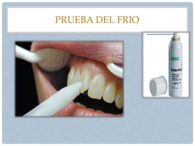 Diagnostico en endodoncia, protocolo, materiales de endodoncia
