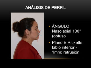 Diagnostico en ortodoncia | PPTX