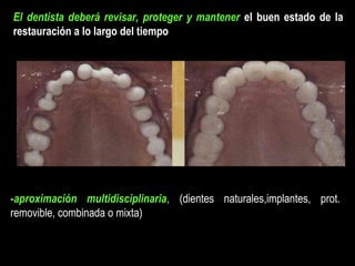 El dentista deberá revisar, proteger y mantener el buen estado de la
restauración a lo largo del tiempo
-aproximación multidisciplinaria, (dientes naturales,implantes, prot.
removible, combinada o mixta)
 