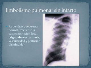  Rx de tórax puede estar
normal, frecuente la
vasoconstriccion local
(signo de westermark,
vascularidad y perfusión
disminuida)
 