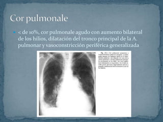  < de 10%, cor pulmonale agudo con aumento bilateral
de los hilios, dilatación del tronco principal de la A.
pulmonar y vasoconstricción periférica generalizada
 