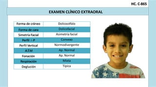 A-
Examen Clínico - Extraoral
C. C-
H 865
EXAMEN CLÍNICO EXTRAORAL
Forma de cráneo Dolicocéfalo
Forma de cara Dolicofacial
Simetría Facial Asimetría facial
Perfil P Convexo
Perfil Vertical Normodivergente
A.T.M Ap. Normal
Fonación Ap. Normal
Respiración Mixta
Deglución Típica
 