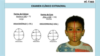 0
4 )
C. C-
H 865
EXAMEN CLÍNICO EXTRAORAL
Forma de Cráneo Forma de Cara
Ancho x 100 = 71 Alto x 100 = 14
Largo Ancho
DOLICOCÉFALO ( <75 ) DOLICOFACIAL(>10
 