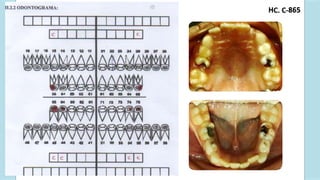 C. C-
H 865
FP
FP
FP FP
 