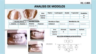 a
nt
C. C-
erta Mordida Cruza
erior Anterior
Entre 63, 73
Mordid Abi
erior Pos
H 865
ANALISIS DE MODELOS
RELACIÓN INTERMAXILAR EN ESTÁTICA
2
I
I I I
15
da Mordida en Tijera Mordida bis a bis
Posterior Unilateral
Arco Alineado Espaciado Apiñado
Superior X
Inferior X
Arco Elíptico Cuadrangular Ovoide Trapezoidal Parabólico
Superior X
Inferior X
Mordida Abierta
Anterior Posterior
 