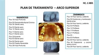 C. C-
H 865
PLAN DE TRATAMIENTO – ARCO SUPERIOR
Pza 55 PeriodontitisApical Crónica
Pza 53 Diente sano
Pza 11 Diente sano
Pza 22 Ausente
Pza 64 Diente sano
DIAGNÓSTICO
Pza 16 Fosa Profunda
Pza 54 Diente sano
Pza 12 Diente sano
Pza 21 Diente sano
Pza 63 Diente sano
Pza 65 Pulpitis Reversible
Pza 26 Fosa Profunda
TRA
TAMIENTO
Pza 16 Flúor barniz y sellante.
Pza 55 Exodoncia y mantenedor
banda ansa.
Pza 54 Flúor barniz y sellante.
Pza 53 Profilaxis
Pza 12 Profilaxis
Pza 11 Profilaxis
Pza 21 Profilaxis
Pza 22 -
Pza 63 Profilaxis
Pza 64 Flúor barniz y sellante.
Pza 65 Pulpotomía y corona
acero-cromo.
Pza 26 Flúor barniz y sellante.
 