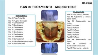 C. C-
H 865
PLAN DE TRATAMIENTO – ARCO INFERIOR
Pza 75 Pulpitis Reversible
DIAGNÓSTICO
Pza 36 Fosa Profunda
Pza 74 Caries dental
Pza 73 Diente sano
Pza 32 Diente sano
Pza 31 Diente sano
Pza 41 Diente sano
Pza 42 Diente sano
Pza 83 Diente sano
Pza 84 Caries dental
Pza 85 Periodontitis apical crónica
Pza 46 Fosa Profunda
TRA
TAMIENTO
Pza 36 Flúor barniz y sellante.
Pza 75 Pulpotomía y corona
acero-cromo.
Pza 74 Restauración con
resina.
Pza 73 Profilaxis
Pza 32 Profilaxis
Pza 31 Profilaxis
Pza 41 Profilaxis
Pza 42 Profilaxis
Pza 83 Profilaxis
Pza 84 Restauración con
resina.
Pza 85 Exodoncia y
mantenedor banda ansa.
Pza 46 Flúor barniz y sellante
 