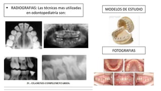  RADIOGRAFIAS: Las técnicas mas utilizadas
en odontopediatría son:
MODELOS DE ESTUDIO
FOTOGRAFIAS
 