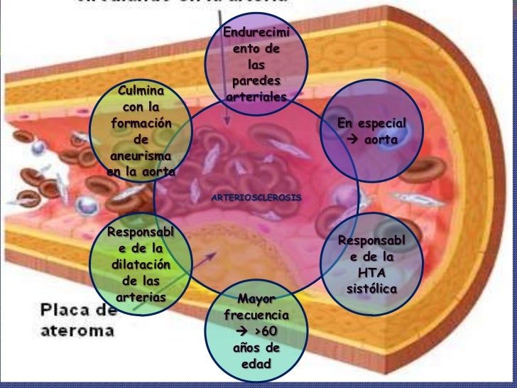 La trombosis el tratamiento por las medicinas