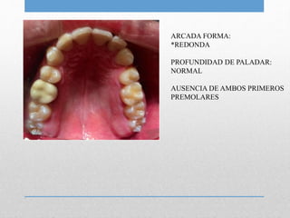 ARCADA FORMA:
*REDONDA
PROFUNDIDAD DE PALADAR:
NORMAL
AUSENCIA DE AMBOS PRIMEROS
PREMOLARES
 