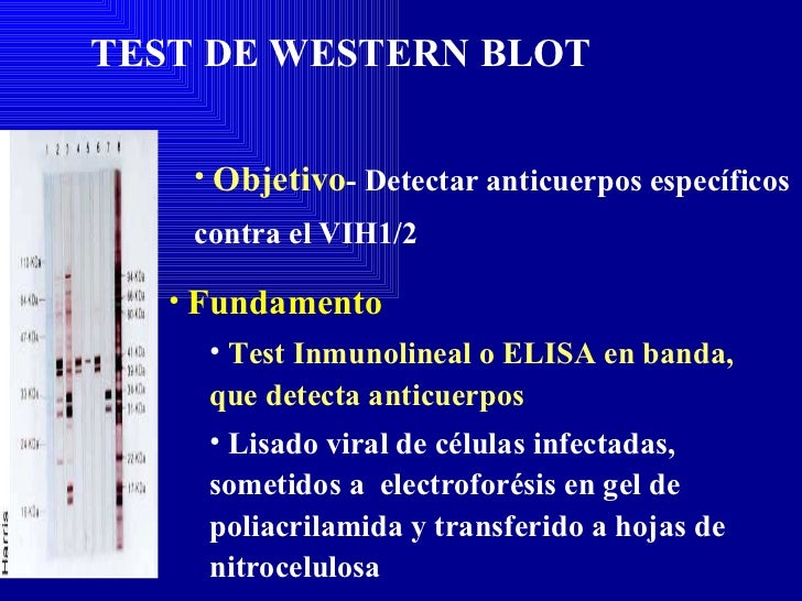 Diagnóstico Laboratorial VIH Diagnóstico Laboratorial VIH