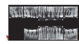 Comprehensive Periodontal Diagnosis: Techniques and Clinical Evaluation ...