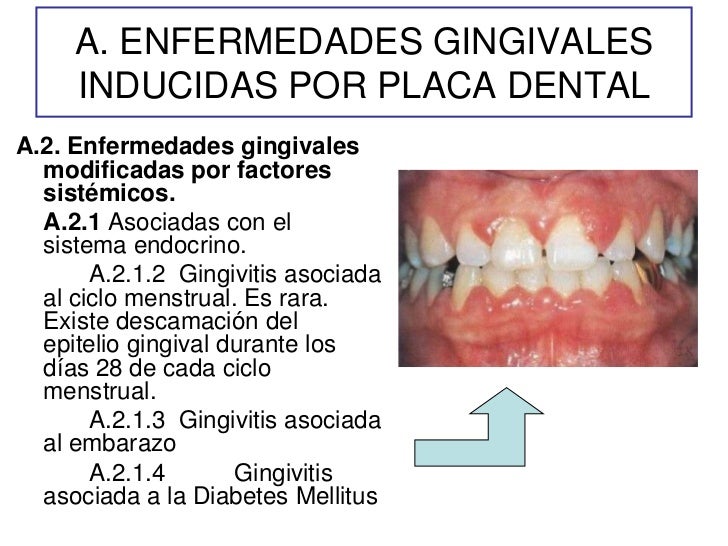 Diagnostico periodontal para rehabilitacion 2012 (resumen)