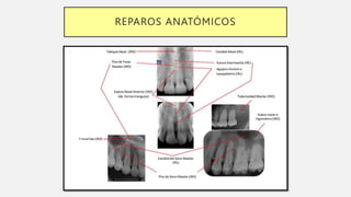 REPAROS ANATÓMICOS
 