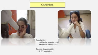 CANINOS
Angulación:
 Maxilar superior: +40°
 Maxilar inferior: -20°
Tiempo de exposición:
 0,5 segundos
 