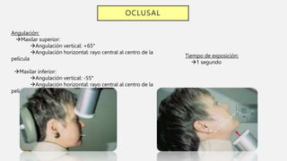 OCLUSAL
Angulación:
Maxilar superior:
Angulación vertical: +65°
Angulación horizontal: rayo central al centro de la
película
Maxilar inferior:
Angulación vertical: -55°
Angulación horizontal: rayo central al centro de la
película
Tiempo de exposición:
1 segundo
 
