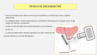 TÉCNICA DE DIECK/BISECTRIZ
 Técnica periapical que abarca todo lo que acontezca a nivel de las raíces y tejidos
adyacentes.
 La radiación debe incidir perpendicular a la bisectriz formada por el ángulo entre el eje
mayor del diente y la película.
 Incide a nivel del ápice de la pieza dentaria a una distancia
 de 20 cm.
 La película debe estar siempre paralela a la cara vestibular de
la pieza dentaria y al tubo del equipo.
 