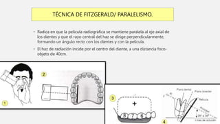  Radica en que la película radiográfica se mantiene paralela al eje axial de
los dientes y que el rayo central del haz se dirige perpendicularmente,
formando un ángulo recto con los dientes y con la película.
 El haz de radiación incide por el centro del diente, a una distancia foco-
objeto de 40cm.
TÉCNICA DE FITZGERALD/ PARALELISMO.
 