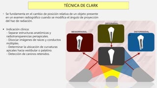 TÉCNICA DE CLARK
 Se fundamenta en el cambio de posición relativa de un objeto presente
en un examen radiográfico cuando se modifica el ángulo de proyección
del haz de radiación.
 Indicación clínica:
- Separar estructuras anatómicas y
radiotransparencias periapicales.
- Disociar imágenes de raíces y conductos
múltiples.
- Determinar la ubicación de curvaturas
apicales hacia vestibular o palatino.
- Detección de caninos retenidos.
 