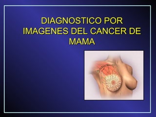 DIAGNOSTICO POR
IMAGENES DEL CANCER DE
        MAMA
 