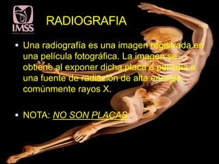 RADIOGRAFIA
 Una radiografía es una imagen registrada en
 una película fotográfica. La imagen se
 obtiene al exponer dicha placa o película a
 una fuente de radiación de alta energía,
 comúnmente rayos X.

 NOTA: NO SON PLACAS
 
