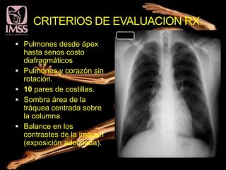 CRITERIOS DE EVALUACION RX.
                              TX.
 Pulmones desde ápex
    hasta senos costo
    diafragmáticos
   Pulmones y corazón sin
    rotación.
   10 pares de costillas.
   Sombra área de la
    tráquea centrada sobre
    la columna.
   Balance en los
    contrastes de la imagen
    (exposición adecuada).
 