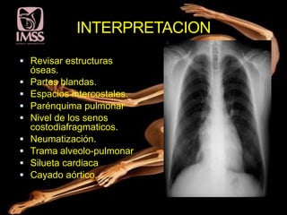 INTERPRETACION
 Revisar estructuras
    óseas.
   Partes blandas.
   Espacios intercostales.
   Parénquima pulmonar
   Nivel de los senos
    costodiafragmaticos.
   Neumatización.
   Trama alveolo-pulmonar
   Silueta cardiaca
   Cayado aórtico.
 