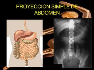 PROYECCION SIMPLE DE
     ABDOMEN
 