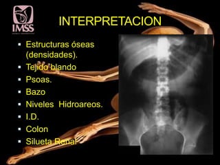 INTERPRETACION
 Estructuras óseas
  (densidades).
 Tejido blando
 Psoas.
 Bazo
 Niveles Hidroareos.
 I.D.
 Colon
 Silueta Renal
 