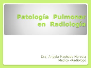 Patología Pulmonar
en Radiología
Dra. Angela Machado Heredia
Medico -Radiólogo
 