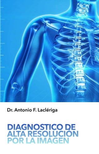 DIAGNOSTICO DE
ALTA RESOLUCIÓN
POR LA IMÁGEN
Dr. Antonio F. Laclériga
 