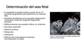 Determinación del sexo fetal
• La ecografía se puede realizar a partir de las 15
semanas de gestación para determinar el sexo del
feto.
• Ejemplos de defectos que se pueden diagnosticar
o descartar mediante ecografía diagnóstica
prenatal:
• Malformaciones que pueden indicar un síndrome
• Genitales anómalos
• Higroma quístico
• Polidactilia
• Onfalocele
• Defectos de metacarpianos laterales
(corresponden al radio)
 