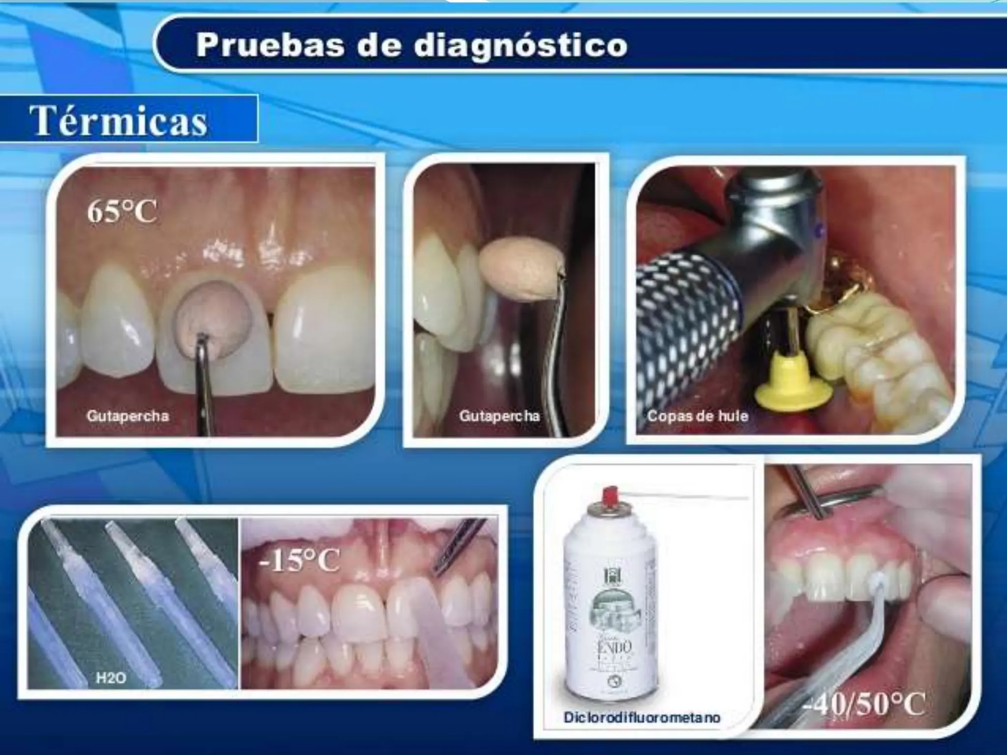DIAGNOSTICO PULPAR.y periapical endo.pptx