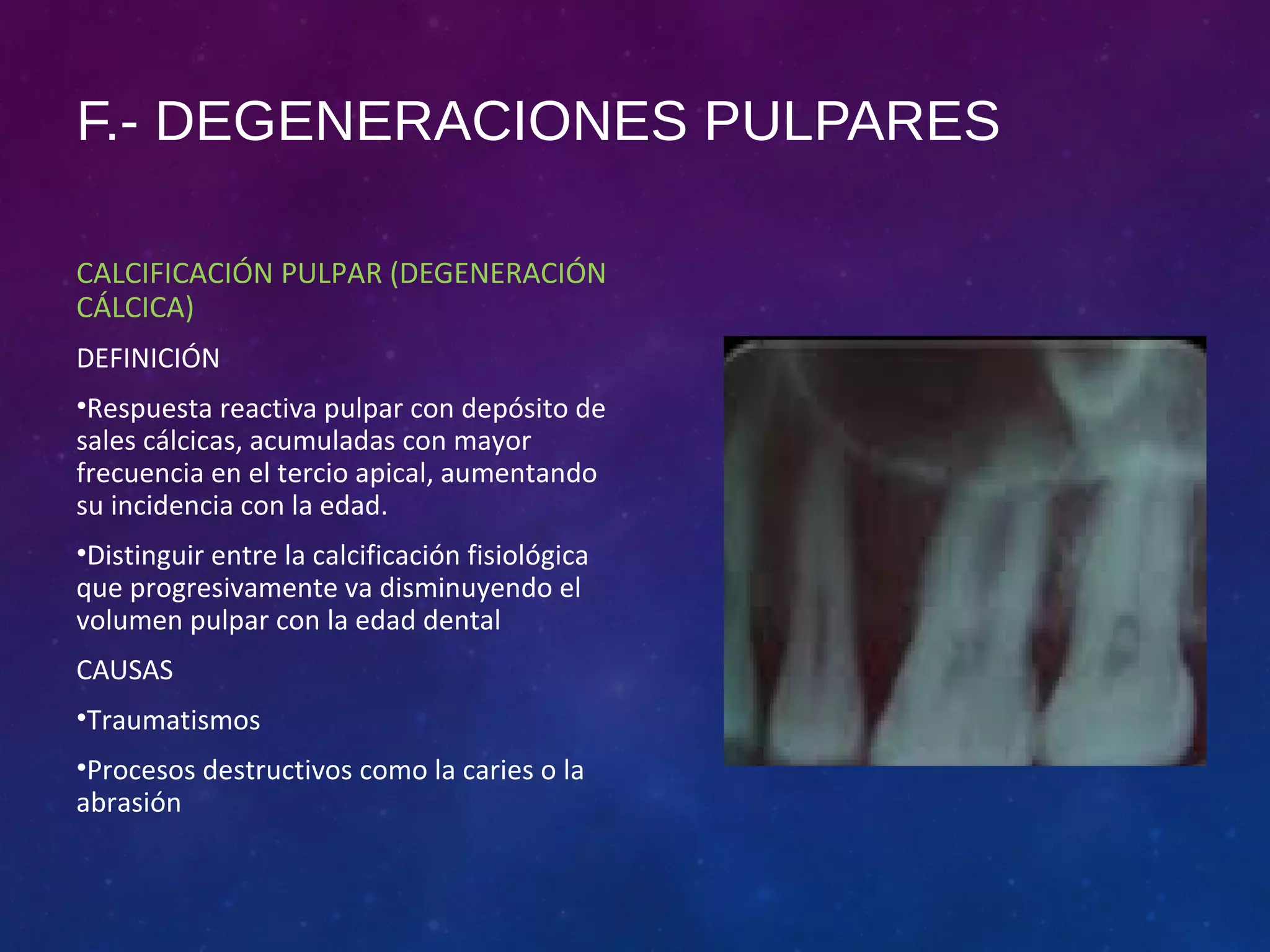 Diagnostico pulpar y patología pulpar PPT