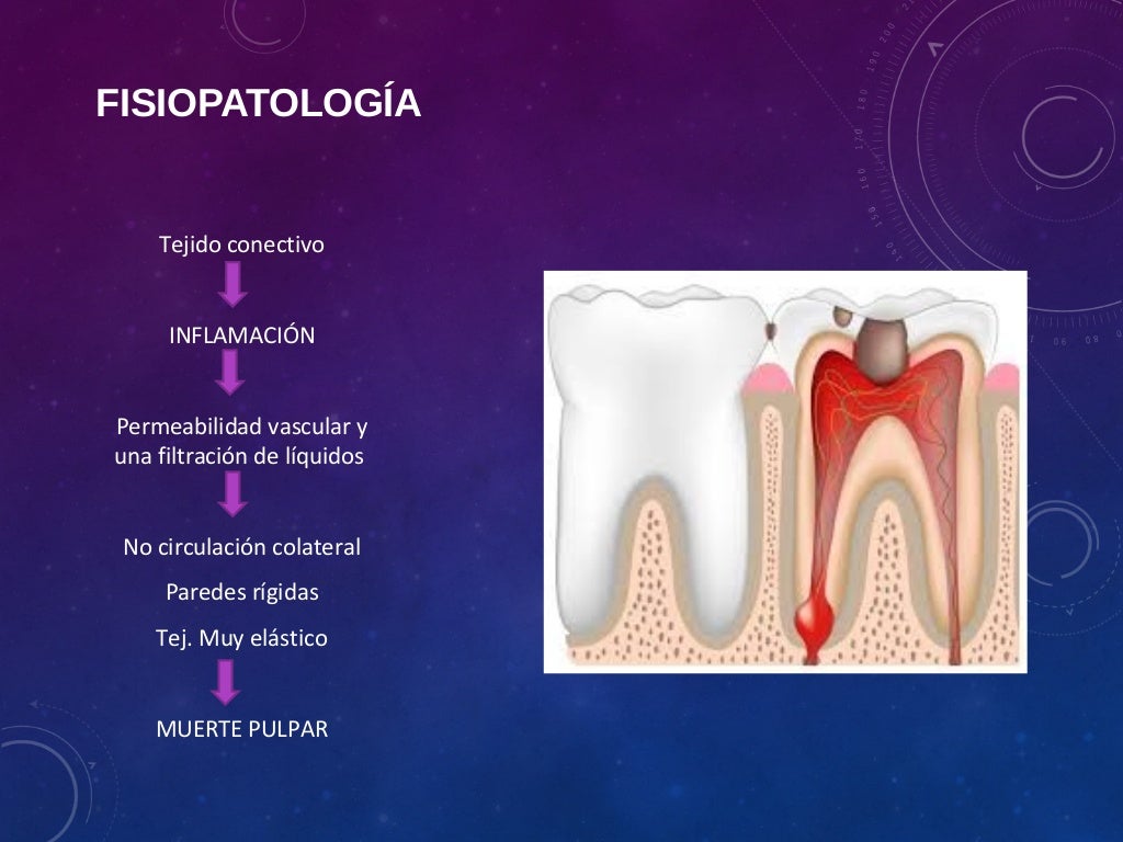 Diagnostico pulpar y patología pulpar