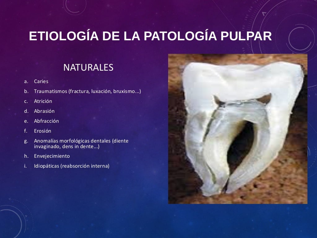 Diagnostico pulpar y patología pulpar