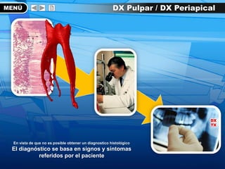 MENÚ DX Pulpar / DX Periapical
DX
TX
En vista de que no es posible obtener un diagnostico histológico
El diagnóstico se basa en signos y síntomas
referidos por el paciente
 